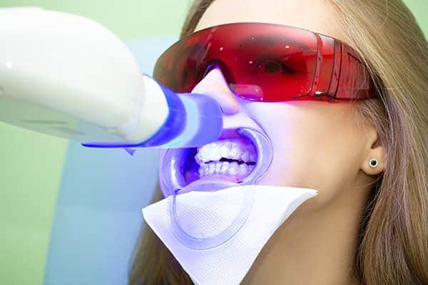 Laser teeth whitening treatments Worthing