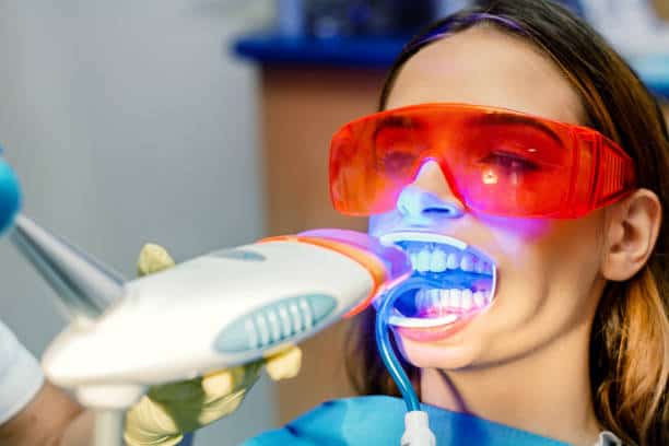 Simplifying Teeth Whitening: A Comprehensive Guide Worthing