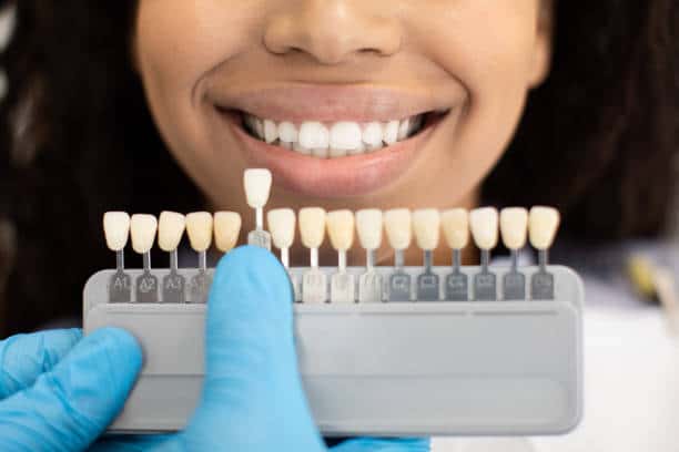 Laser Teeth Whitening: Exploring the Longevity of Your Brighter Smile Worthing