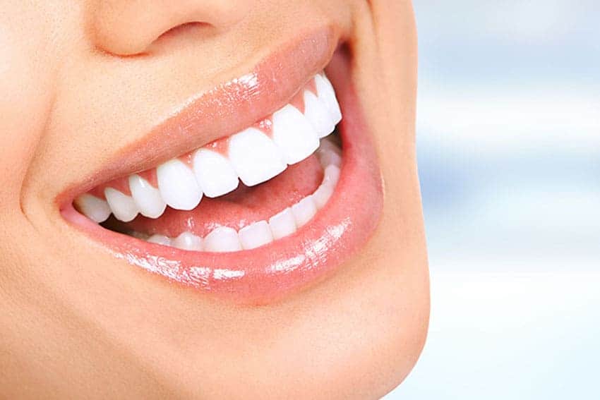 Teeth Whitening Abingdon Worthing