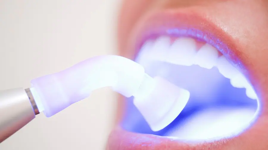 Teeth Whitening Aylesbury Worthing